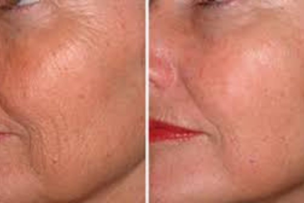 Top Skin Care for Mature Skin Anti-Ageing Facials and Deep Wrinkle Solutions